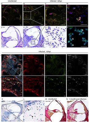 Anti-inflammatory and Oto-Protective Effect of the Small Heat Shock Protein Alpha B-Crystallin (HspB5) in Experimental Pneumococcal Meningitis